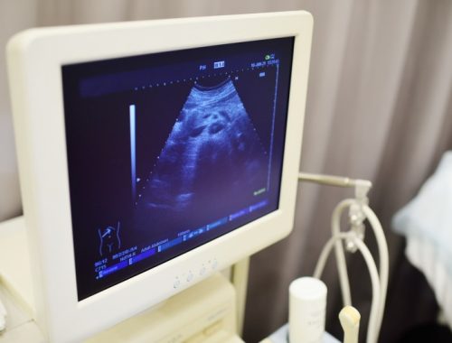 Relacja z przebiegu ultrasonograficznego badania diagnostycznego