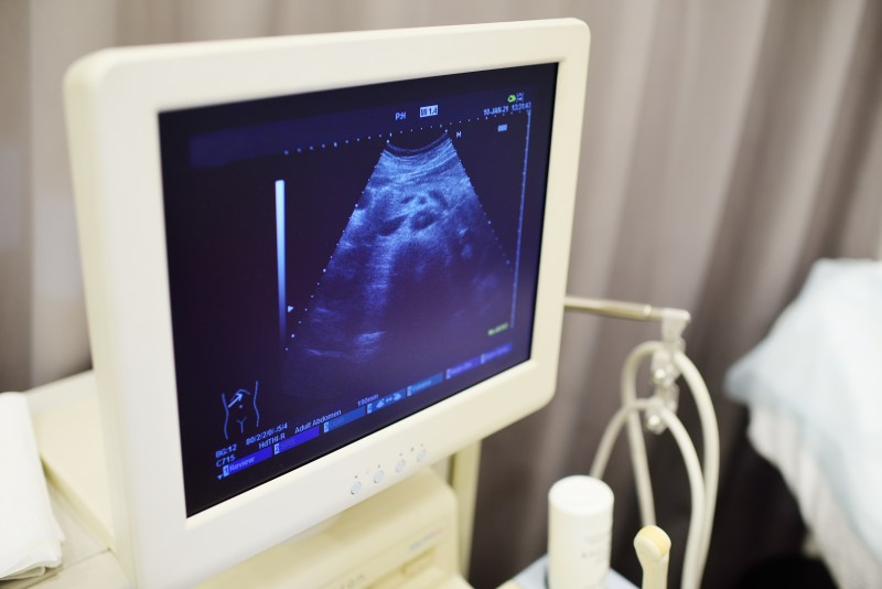 Relacja z przebiegu ultrasonograficznego badania diagnostycznego