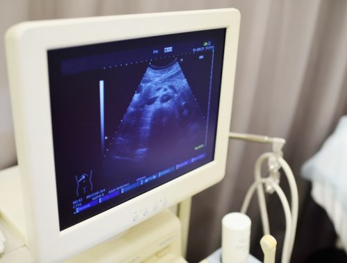 Bezpieczeństwo badań ultrasonograficznych w trakcie ciąży