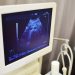 Bezpieczeństwo badań ultrasonograficznych w trakcie ciąży